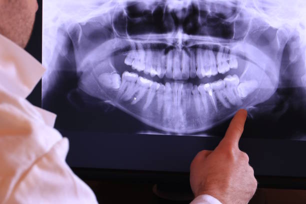 Best Emergency Dental Care for Abscessed Tooth in Central Garage, VA
