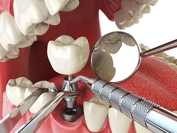 Best Emergency Dentist for Special Needs Patients in Central Garage, VA
